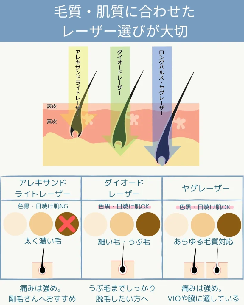 医療レーザーの説明