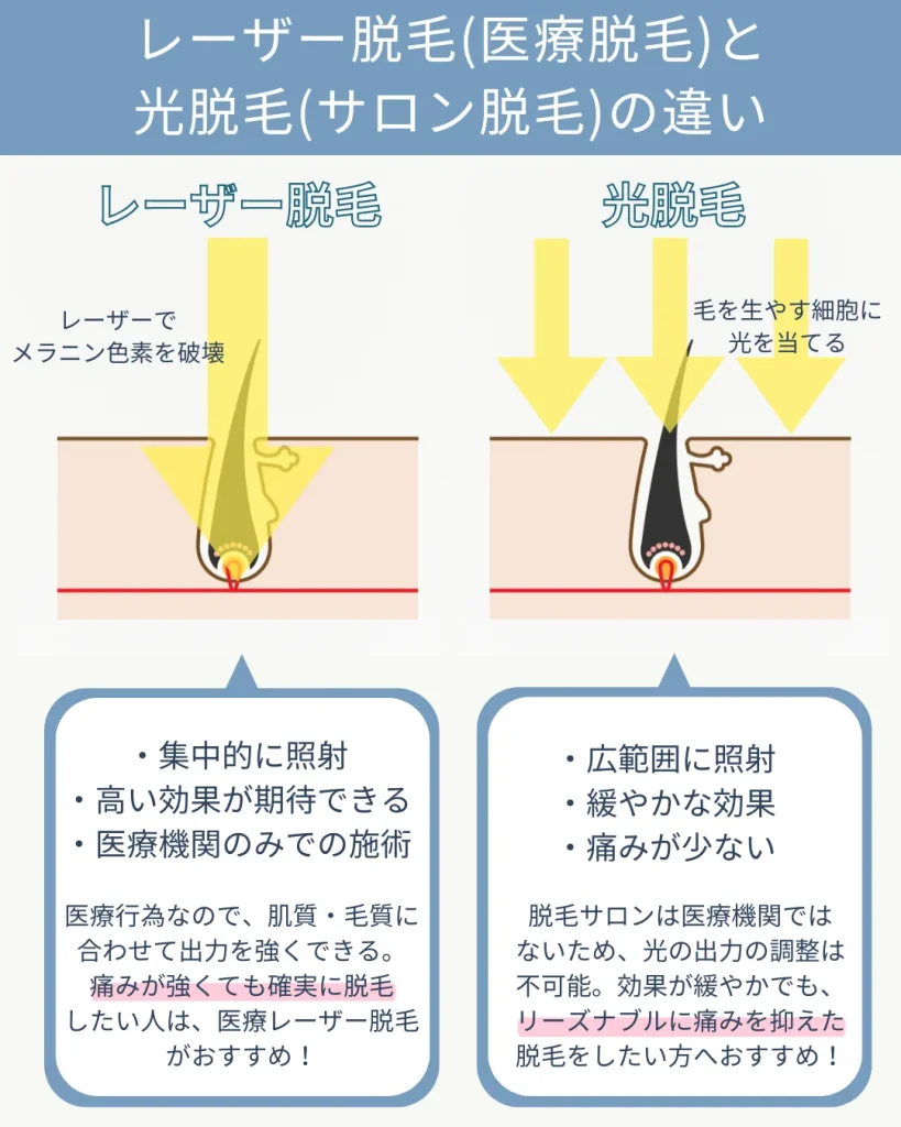 医療脱毛とサロン脱毛のレーザーの違い