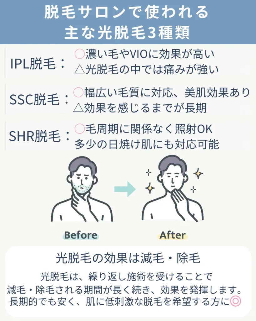 光脱毛の種類