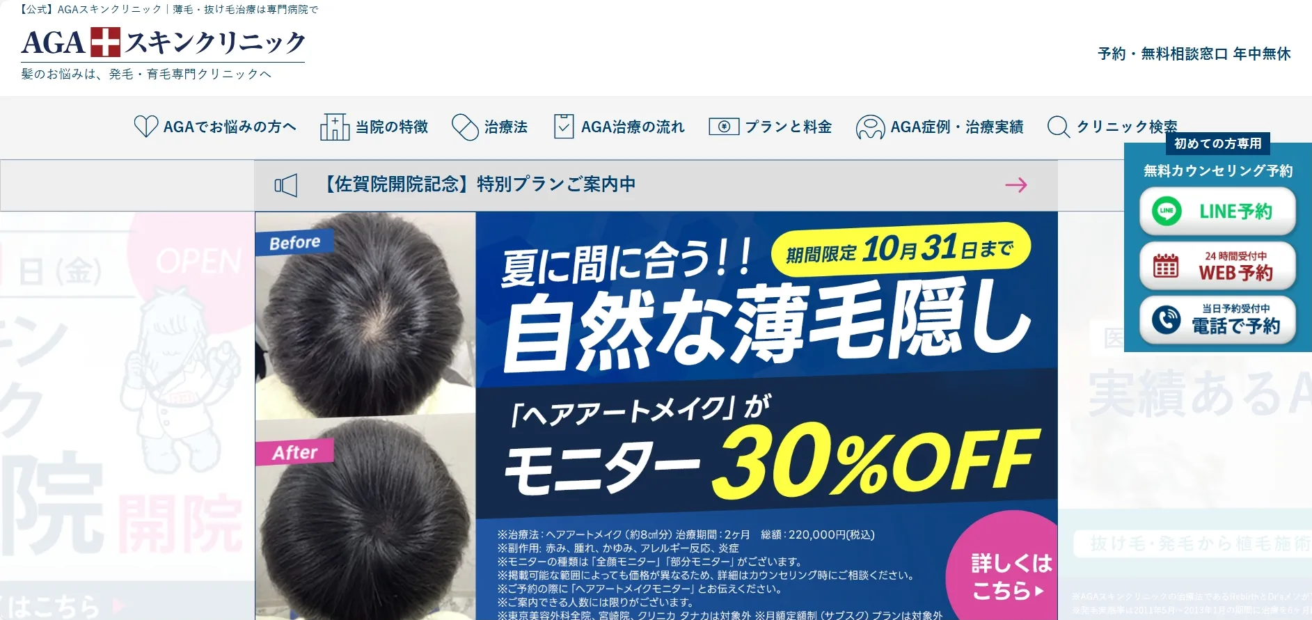AGAスキンクリニック